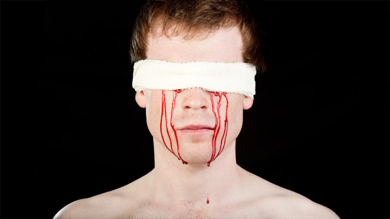 Bleeding Eyes